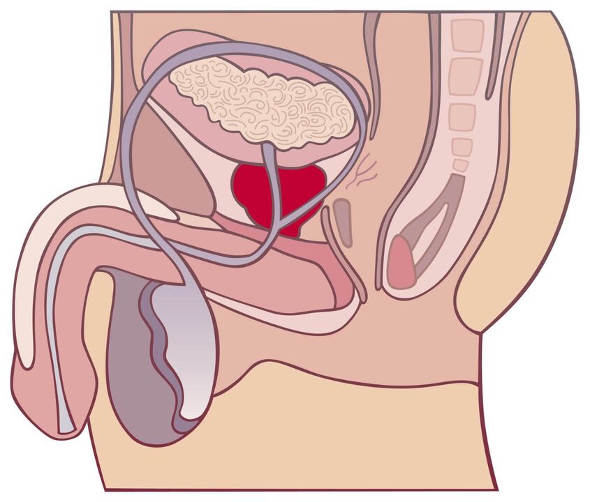 Todo sobre la prostatitis