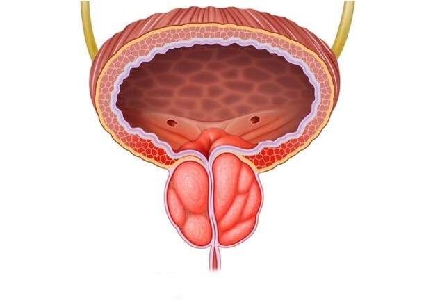 inflamación de la próstata en los hombres