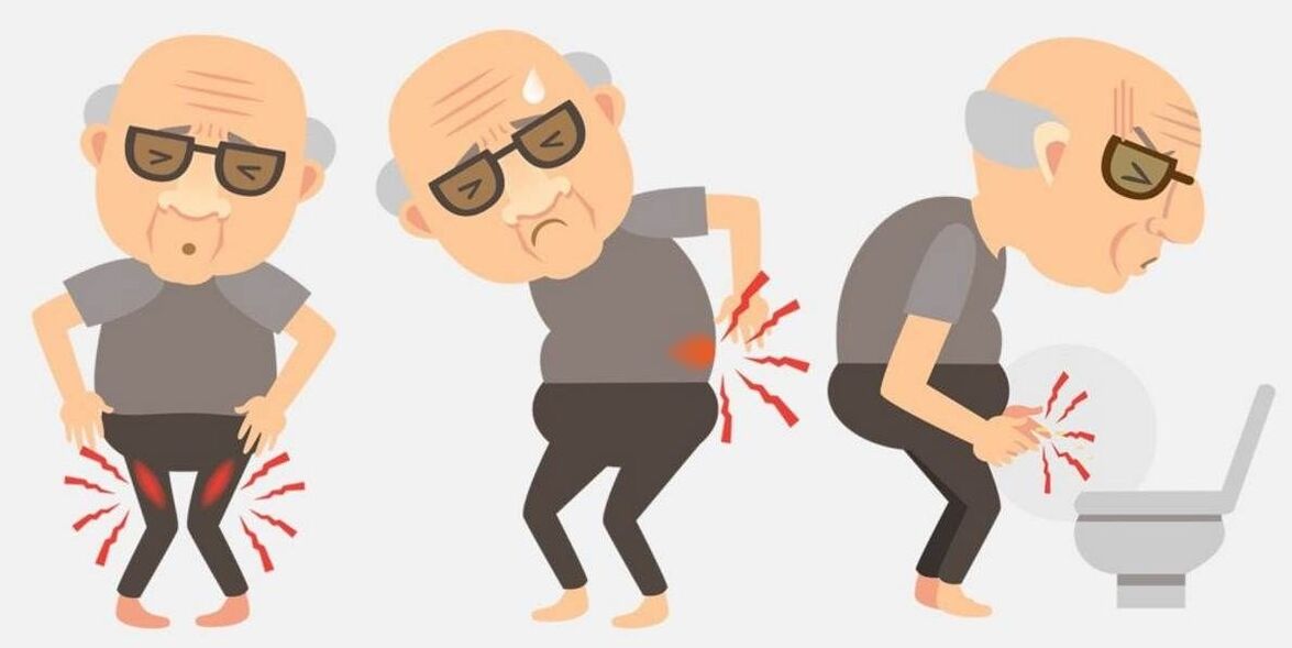 síntomas de prostatitis