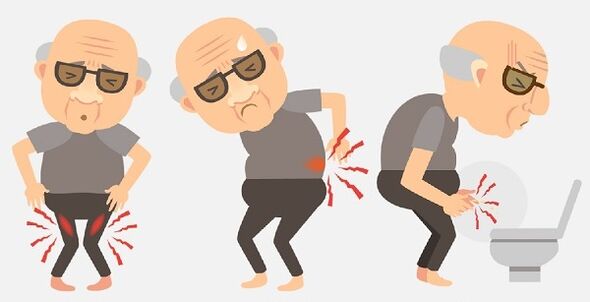 Síntomas de prostatitis y su tratamiento con medicamentos.